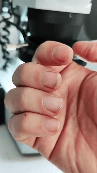 震惊！用显微镜看下指甲缝里的东西