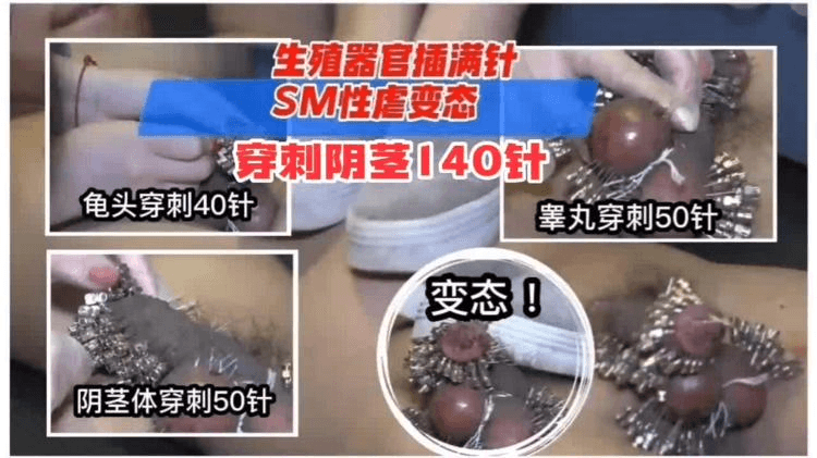 重口变态系列。。胆小勿进,生殖器官被插满针,SM性虐变态穿针140针