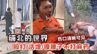 【缅北禁区】缅北的世界_殴打_活埋_噶腰子不打麻药伤口清晰可见