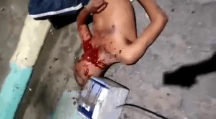 一枪打到颈动脉