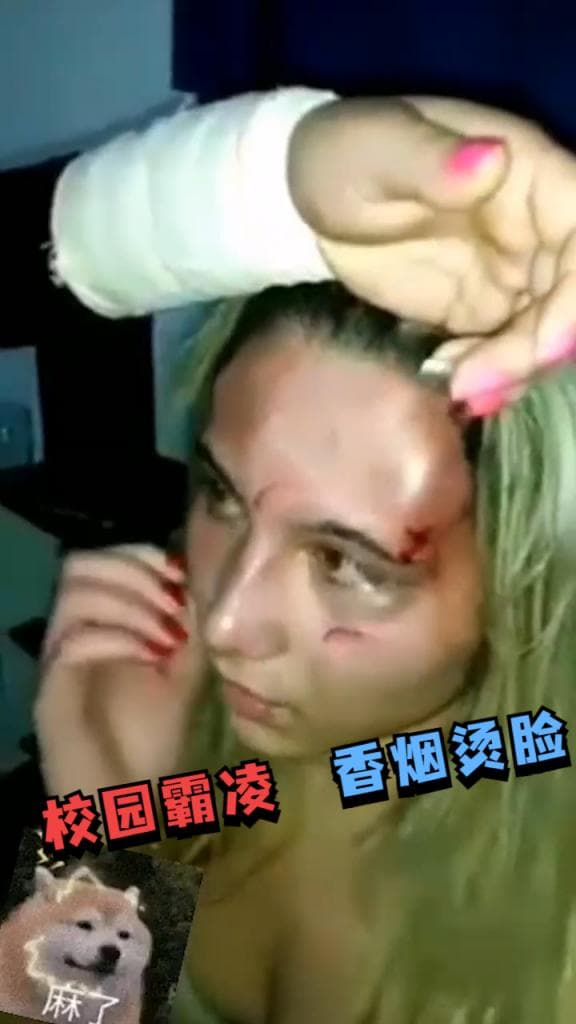 国外的校园霸凌，香烟烫脸小姐姐都被打脸肿了